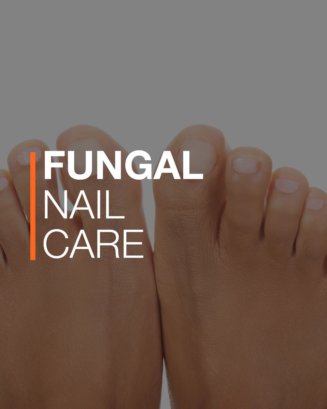 Fungal Nail Treatment
