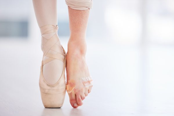 stress fracture dance