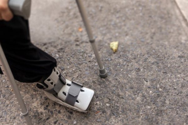 Physio in bone fracture rehab camberwell