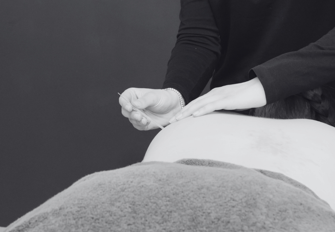 Myotherapy CSSM