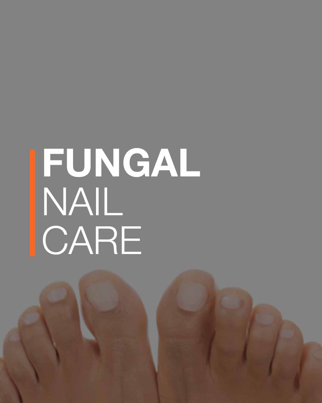 Fungal Nail Treatment info